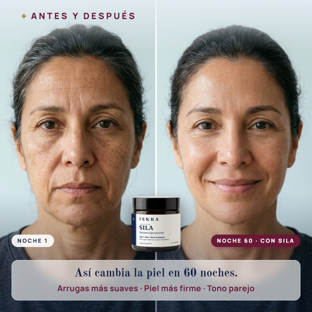 Antes y después: así cambia la piel en 60 noches con ISKRA SILA