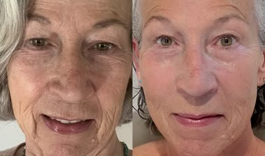 Norma, 64 años