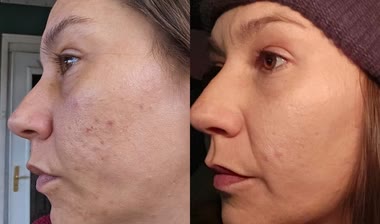 Valeria, 41 años